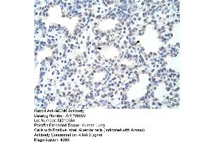Human Intestine (MCM6 antibody  (C-Term))