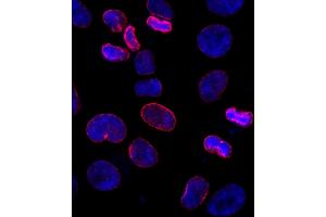 Immunofluorescence (IF) image for anti-Nucleoporin 153kDa (NUP153) (AA 50-100) antibody (ABIN7448391) (NUP153 antibody  (AA 50-100))