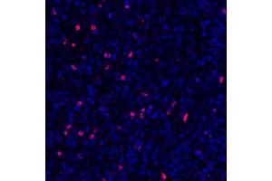 Immunofluorescence (IF) image for anti-Forkhead Box P3 (FOXP3) (AA 275-325) antibody (ABIN7455209) (Recombinant FOXP3 antibody  (AA 275-325))