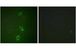 Immunofluorescence (IF) image for anti-Potassium Inwardly-Rectifying Channel, Subfamily J, Member 1 (KCNJ1) (AA 11-60) antibody (ABIN2888901) (KCNJ1 antibody  (AA 11-60))