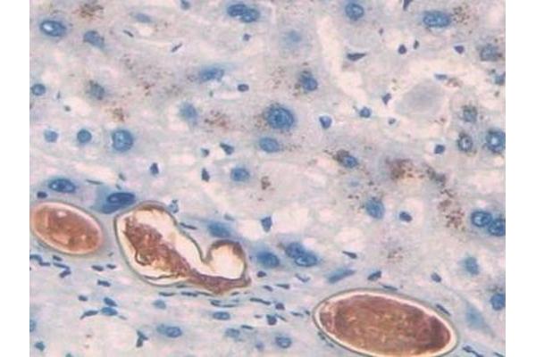 Angiotensin 1-7 antibody