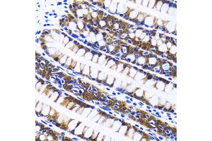 Immunohistochemistry of paraffin-embedded human colon using FASN antibody (ABIN1872662) at dilution of 1:100 (40x lens). (Fatty Acid Synthase antibody)