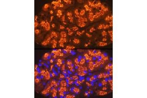 Immunofluorescence (IF) image for anti-Chymotrypsin (CTRL) antibody (ABIN7266395)