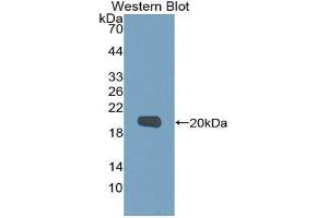 Western Blotting (WB) image for anti-Matrix Metallopeptidase 9 (Gelatinase B, 92kDa Gelatinase, 92kDa Type IV Collagenase) (MMP9) (AA 213-399) antibody (ABIN1078310) (MMP 9 antibody  (AA 213-399))