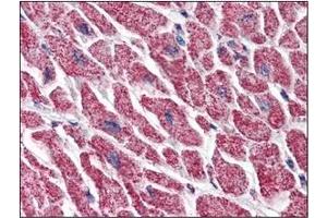 Immunohistochemistry (IHC) image for anti-Heat Shock Protein 90kDa beta (Grp94), Member 1 (HSP90B1) (AA 676-803) antibody (ABIN317570)