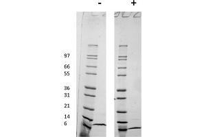 SDS-PAGE of Human Macrophage Inflammatory Protein-4 (CCL18) Recombinant Protein SDS-PAGE of Human Macrophage Inflammatory Protein-4 (CCL18) Recombinant Protein.