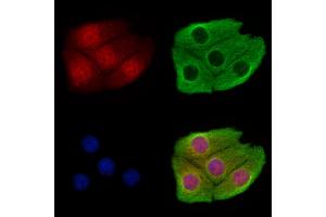 ABIN7094493 and ABIN7098542 staining Hela cells by IF/ICC.
