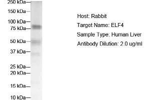 WB Suggested Anti-ELF4 Antibody Titration:  2 ug/ml  ELISA Titer:  1:312500  Positive Control:  Human Liver (Elf4 antibody  (N-Term))