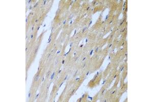 Immunohistochemistry of paraffin-embedded rat heart using ROCK1 antibody (ABIN5974704) at dilution of 1/100 (40x lens).