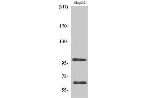 Western Blotting (WB) image for anti-Signal-Regulatory Protein alpha (SIRPA) (C-Term) antibody (ABIN3177417) (SIRPA antibody  (C-Term))