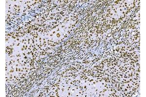 IHC analysis of CTBP2 using anti-CTBP2 antibody (ABIN7601326). (CTBP2 antibody  (AA 321-445))