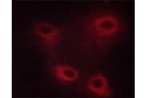 ABIN6267507 staining HUVEC cells by ICC/IF. (MAP3K8 antibody  (pThr290))