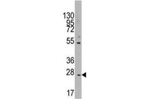 Western blot analysis of CD8B in K562 lysate (CD8B antibody  (AA 64-92))