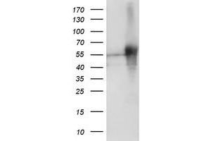 HEK293T cells were transfected with the pCMV6-ENTRY control (Left lane) or pCMV6-ENTRY SH2D2A (Right lane) cDNA for 48 hrs and lysed. (SH2D2A antibody)