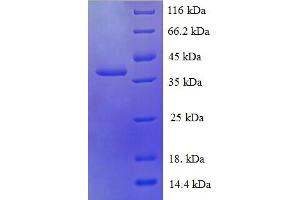 SDS-PAGE (SDS) image for Ribosomal Protein L30 (RPL30) (AA 1-115), (full length) protein (GST tag) (ABIN5710276)
