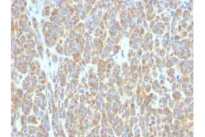 Image no. 1 for anti-B-Cell CLL/lymphoma 6 (BCL6) antibody (ABIN6175703) (BCL6 antibody)