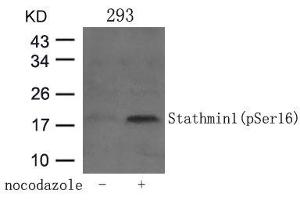 Western blot analysis of extracts from 293 cells untreated or treated with Nocodazol using Stathmin 1(Phospho-Ser16) Antibody. (Stathmin 1 antibody  (pSer16))