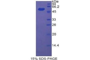 SDS-PAGE analysis of Rat ENPP1 Protein. (ENPP1 Protein)