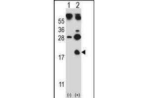 Western blot analysis of HBG1 (arrow) using rabbit polyclonal HBG1 Antibody (Center) (ABIN657619 and ABIN2846615). (HBG1 antibody  (AA 56-85))