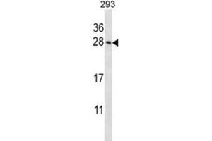 Western Blotting (WB) image for anti-Homeobox B4 (HOXB4) antibody (ABIN2998005) (HOXB4 antibody)