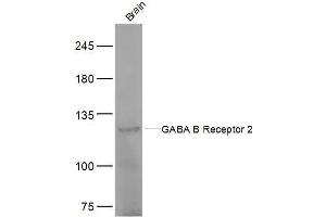 Mouse brain lysates probed with GABA B Receptor 2 Polyclonal Antibody, Unconjugated  at 1:500 dilution and 4˚C overnight incubation. (GABBR2 antibody  (AA 501-650))