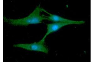 ICC/IF analysis of Synaptobrevin2 in U87MG cells line, stained with DAPI (Blue) for nucleus staining and monoclonal anti-human Synaptobrevin2 antibody (1:100) with goat anti-mouse IgG-Alexa fluor 488 conjugate (Green). (VAMP2 antibody)