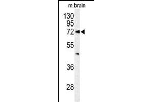 Western blot analysis of ABCD2 Antibody (Center) (ABIN653579 and ABIN2842954) in mouse brain tissue lysates (35 μg/lane). (CCL17 antibody  (AA 269-298))