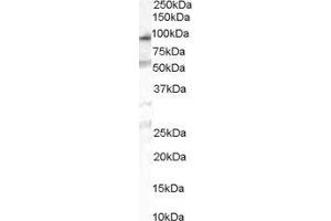 ABIN2564304 (1µg/ml) staining of human duodenum lysate (35µg protein in RIPA buffer). (OSBPL10 antibody  (Internal Region))
