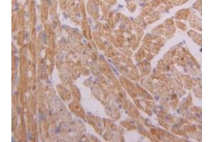 DAB staining on IHC-P; Samples: Mouse Heart Tissue (Hexokinase 1 antibody  (AA 676-800))