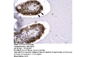 Human Intestine (SIRT5 antibody  (C-Term))