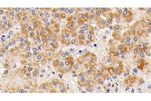 Immunohistochemistry (IHC) image for anti-Cytochrome C, Somatic (CYCS) (AA 13-99) antibody (ABIN7440230)