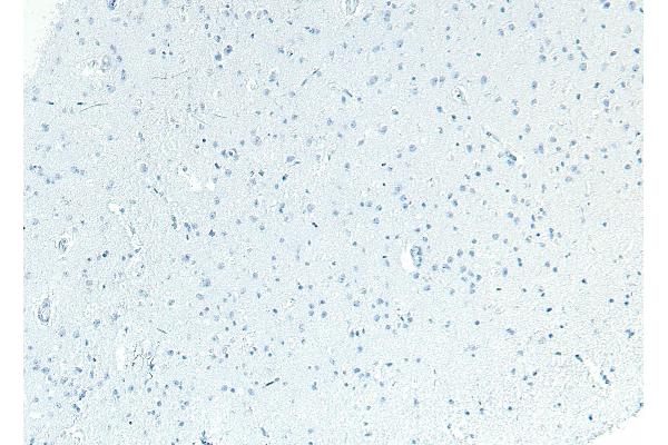Patched 1 antibody  (C-Term)