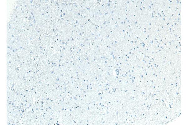 Patched 1 antibody  (C-Term)