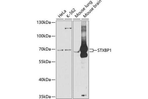STXBP1 anticorps  (AA 295-594)