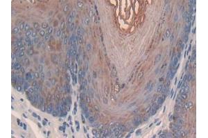 DAB staining on IHC-P; Samples: Mouse Esophagus Tissue (SLPI antibody  (AA 20-131))