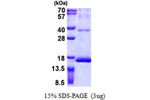 SDS-PAGE (SDS) image for Ribosomal Protein S12 (RPS12) (AA 1-132) protein (His tag) (ABIN5852999) (RPS12 Protein (AA 1-132) (His tag))