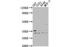 Western Blot Positive WB detected in: U87 whole cell lysate, U251 whole cell lysate, A549 whole cell lysate, MCF-7 whole cell lysate All lanes: ATP6V1D antibody at 1:2000 Secondary Goat polyclonal to rabbit IgG at 1/50000 dilution Predicted band size: 29 kDa Observed band size: 29 kDa (ATP6V1D antibody  (AA 1-247))