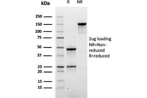 SDS-PAGE Analysis of Purified Desmoglein-3 Mouse Monoclonal Antibody (DSG3/2840). (Desmoglein 3 antibody  (AA 379-491))