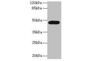 Western blot All lanes: LIPA antibody at 10 μg/mL + A431 whole cell lysate Secondary Goat polyclonal to rabbit IgG at 1/10000 dilution Predicted band size: 46, 40 kDa Observed band size: 46 kDa (Lipase A antibody  (AA 22-399))