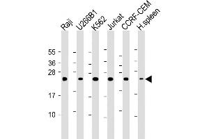All lanes : Anti- CTLA4 Antibody (N-term) at 1:2000 dilution Lane 1: Raji whole cell lysate Lane 2: U266B1 whole cell lysate Lane 3: K562 whole cell lysate Lane 4: Jurkat whole cell lysate Lane 5: CCRF-CEM whole cell lysate Lane 6: Human spleen lysate Lysates/proteins at 20 μg per lane. (CTLA4 antibody  (AA 50-78))