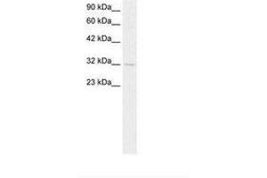 Image no. 2 for anti-Kv Channel Interacting Protein 3, Calsenilin (KCNIP3) (AA 70-119) antibody (ABIN6736266) (DREAM antibody  (AA 70-119))