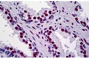 Human Prostate: Formalin-Fixed, Paraffin-Embedded (FFPE) (KAP1 antibody  (AA 379-524))