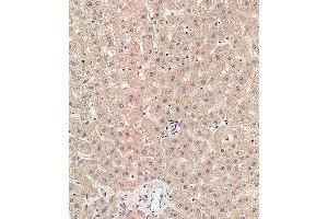Immunohistochemical analysis of paraffin-embedded human liver tissue using (ABIN657731 and ABIN2846716) performed on the Leica® BOND RXm. (RAB1B antibody  (C-Term))