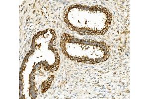 IHC analysis of Hexokinase 1/HK1 using anti-Hexokinase 1/HK1 antibody (ABIN7600258).
