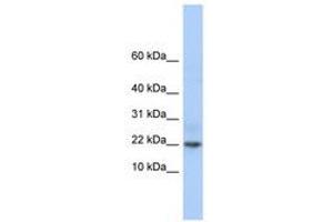 Image no. 1 for anti-Chromosome 9 Open Reading Frame 25 (C9orf25) (C-Term) antibody (ABIN6741337) (C9orf25 antibody  (C-Term))