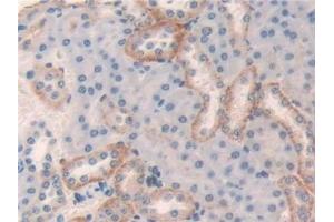 Immunohistochemistry (IHC) image for anti-Legumain (LGMN) (AA 18-435) antibody (ABIN7440881)