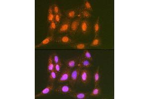 Immunofluorescence analysis of C6 cells using LTH Rabbit mAb (ABIN7268244) at dilution of 1:100 (40x lens). (LTA4H antibody)