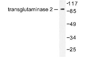 Image no. 1 for anti-Transglutaminase 2 (C Polypeptide, Protein-Glutamine-gamma-Glutamyltransferase) (TGM2) antibody (ABIN271855) (Transglutaminase 2 antibody)