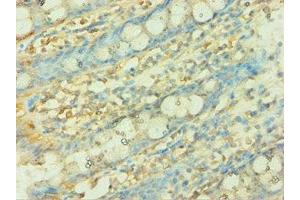 Immunohistochemistry of paraffin-embedded human colon tissue using ABIN7149303 at dilution of 1:100 (CISH antibody  (AA 1-257))