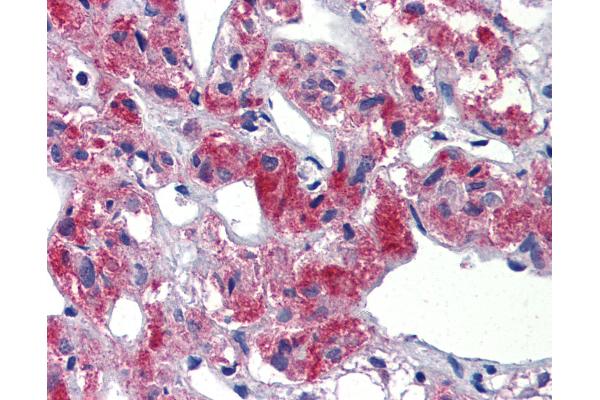 TAL1 antibody  (C-Term)